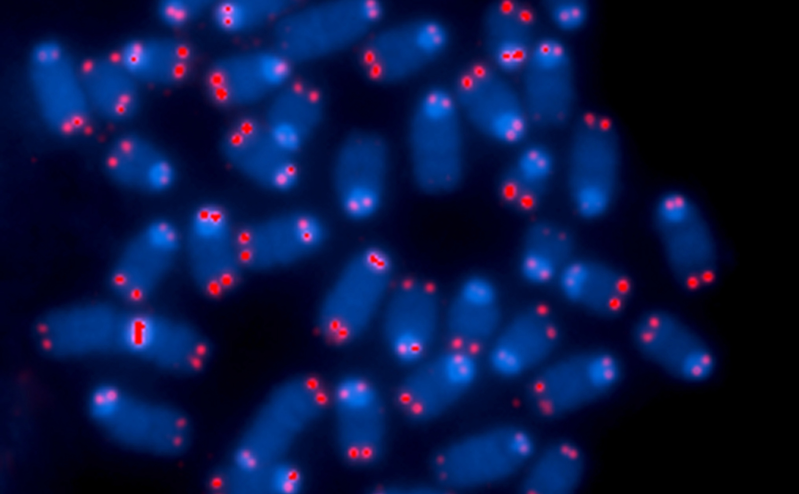 Telomeres under fluorescence microscopy — Sierra Sciences research